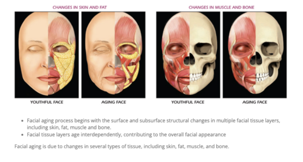 Image of skin changes post menopause